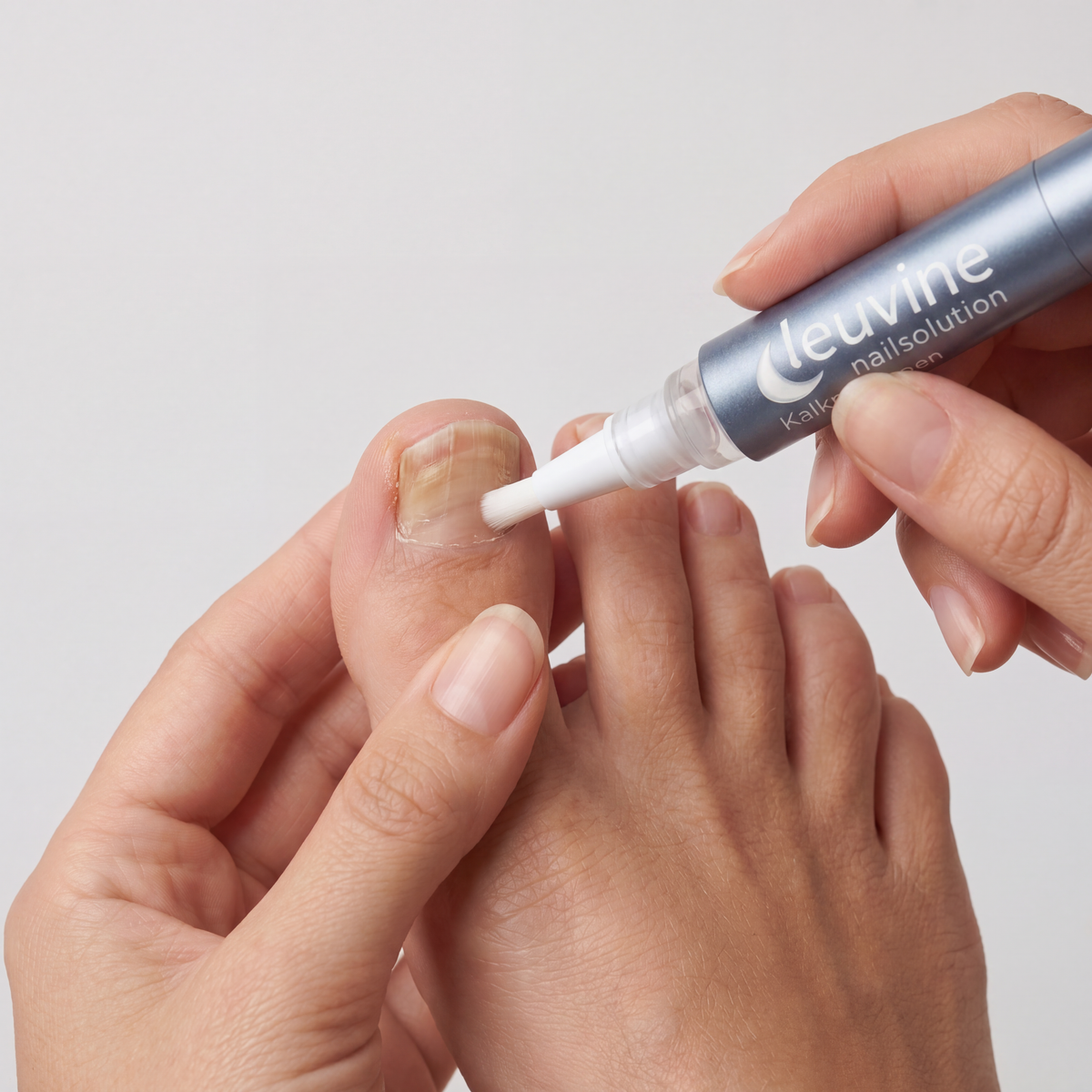 Hand brengt de Leuvine nagelpen aan op een teennagel