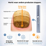 Doorsnede van een aangetaste teennagel met nageloppervlak, nagelplaat en nagelbed, naast de Leuvine pen