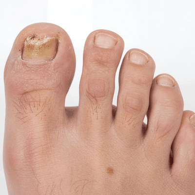 Voor AFTER 30 WEEKS